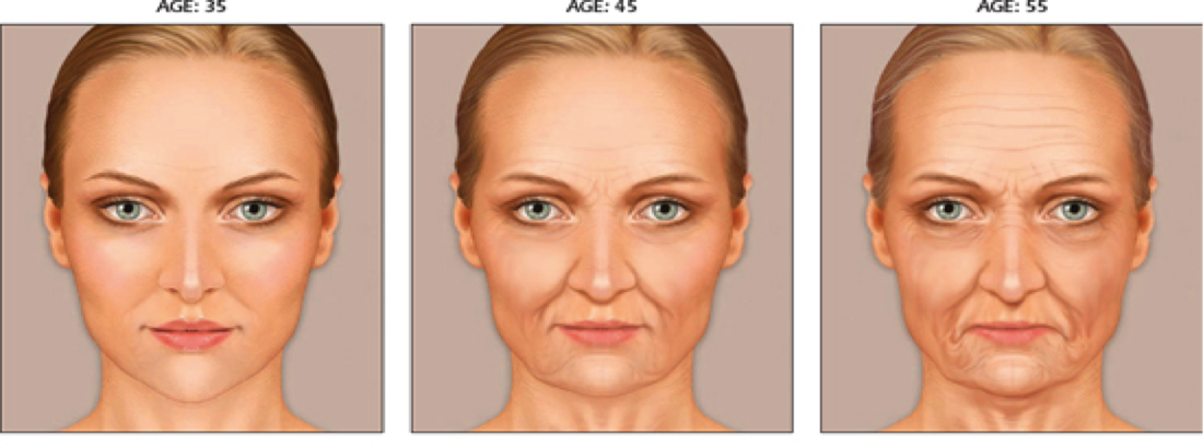 progressions of appearance ageing